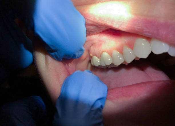 Best Weekend Emergency Dentist in Broadlands, VA