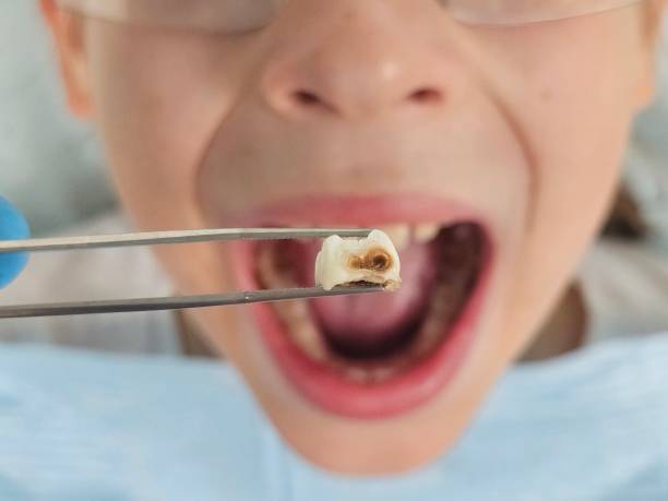 Best Emergency Dental Surgery in Broadlands, VA